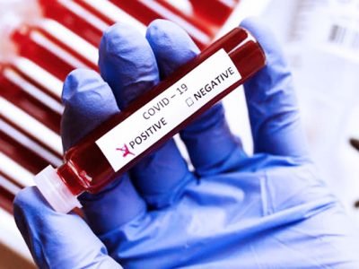 Saudi Arabia announced 119 new Coronavirus cases Total 511