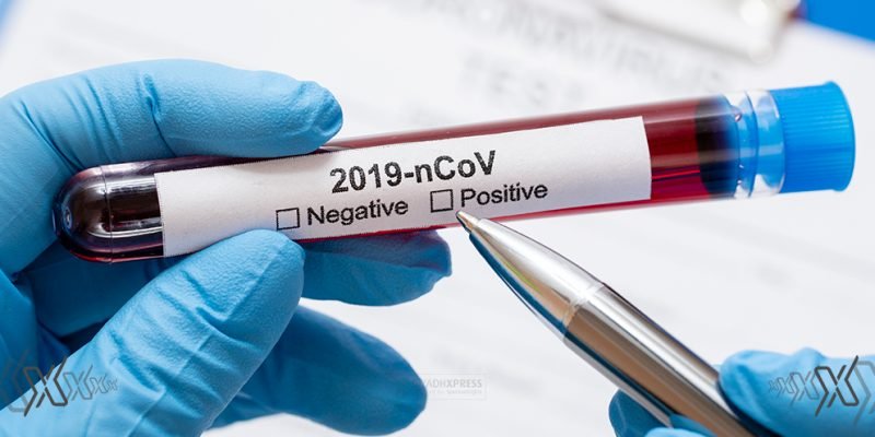 new coronavirus cases riyadh xpress