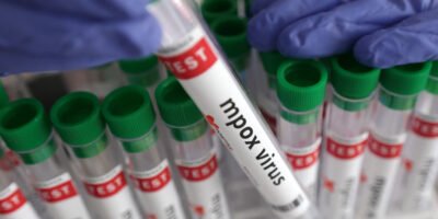 Saudi Arabia Reports No Cases of New Monkeypox Strain